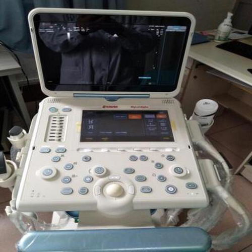 超声仪